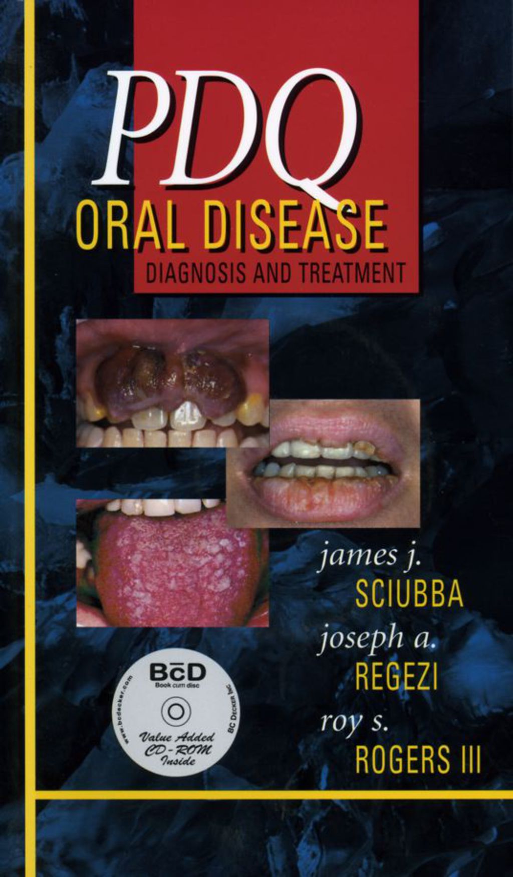 PDQ Oral Disease: Diagnosis and Treatment 1st Edition â€“ PDF/EPUB Version Downloadable