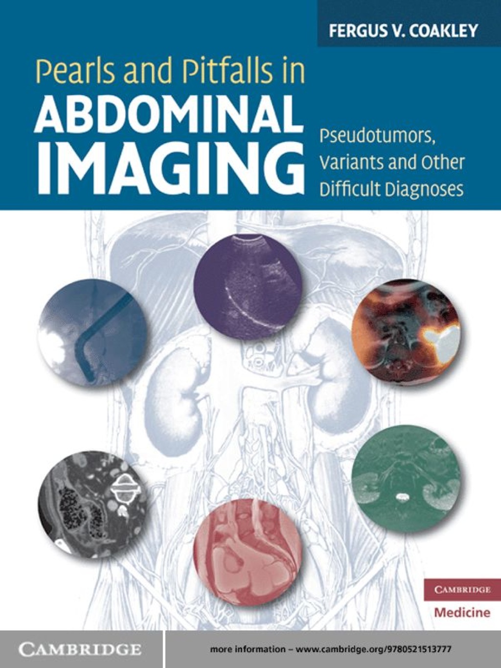 Pearls and Pitfalls in Abdominal Imaging Pseudotumors, Variants and Other Difficult Diagnoses 1st Edition â€“ PDF/EPUB Version Downloadable