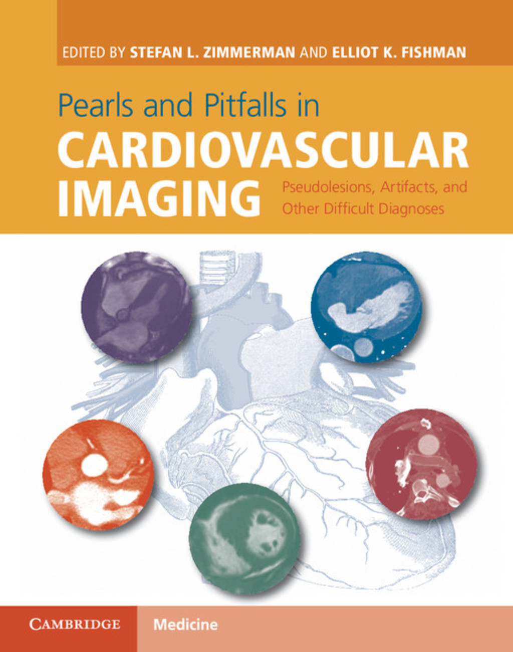 Pearls and Pitfalls in Cardiovascular Imaging Pseudolesions, Artifacts, and Other Difficult Diagnoses 1st Edition â€“ PDF/EPUB Version Downloadable