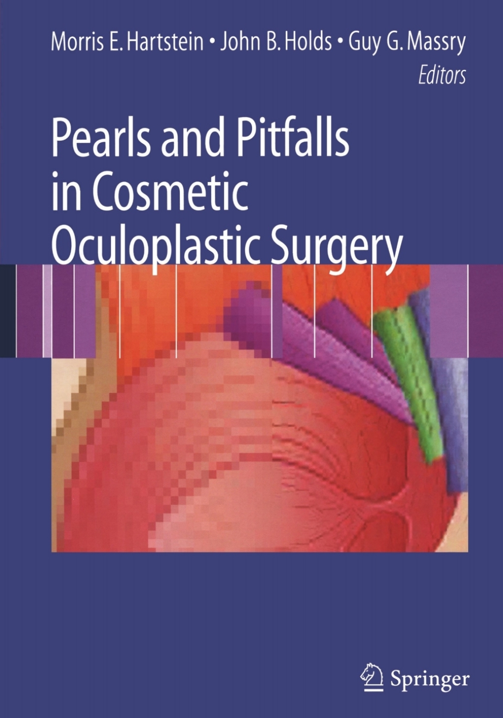 Pearls and Pitfalls in Cosmetic Oculoplastic Surgery 1st Edition â€“ PDF/EPUB Version Downloadable