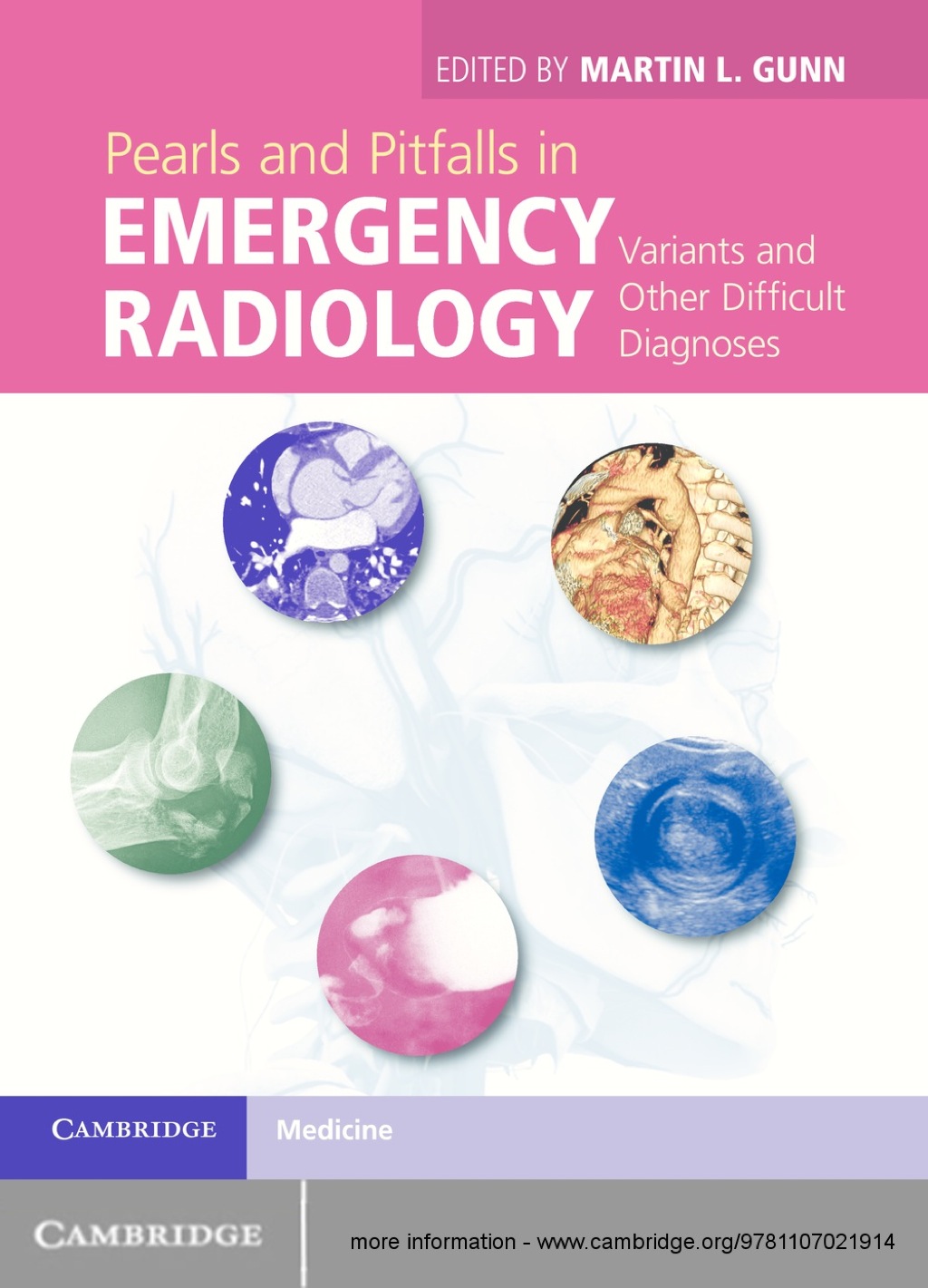 Pearls and Pitfalls in Emergency Radiology Variants and Other Difficult Diagnoses 1st Edition â€“ PDF/EPUB Version Downloadable