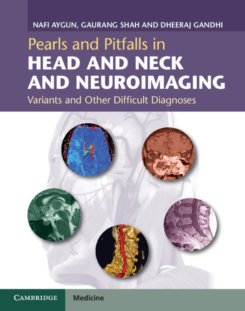 Pearls and Pitfalls in Head and Neck and Neuroimaging Variants and Other Difficult Diagnoses 1st Edition â€“ PDF/EPUB Version Downloadable