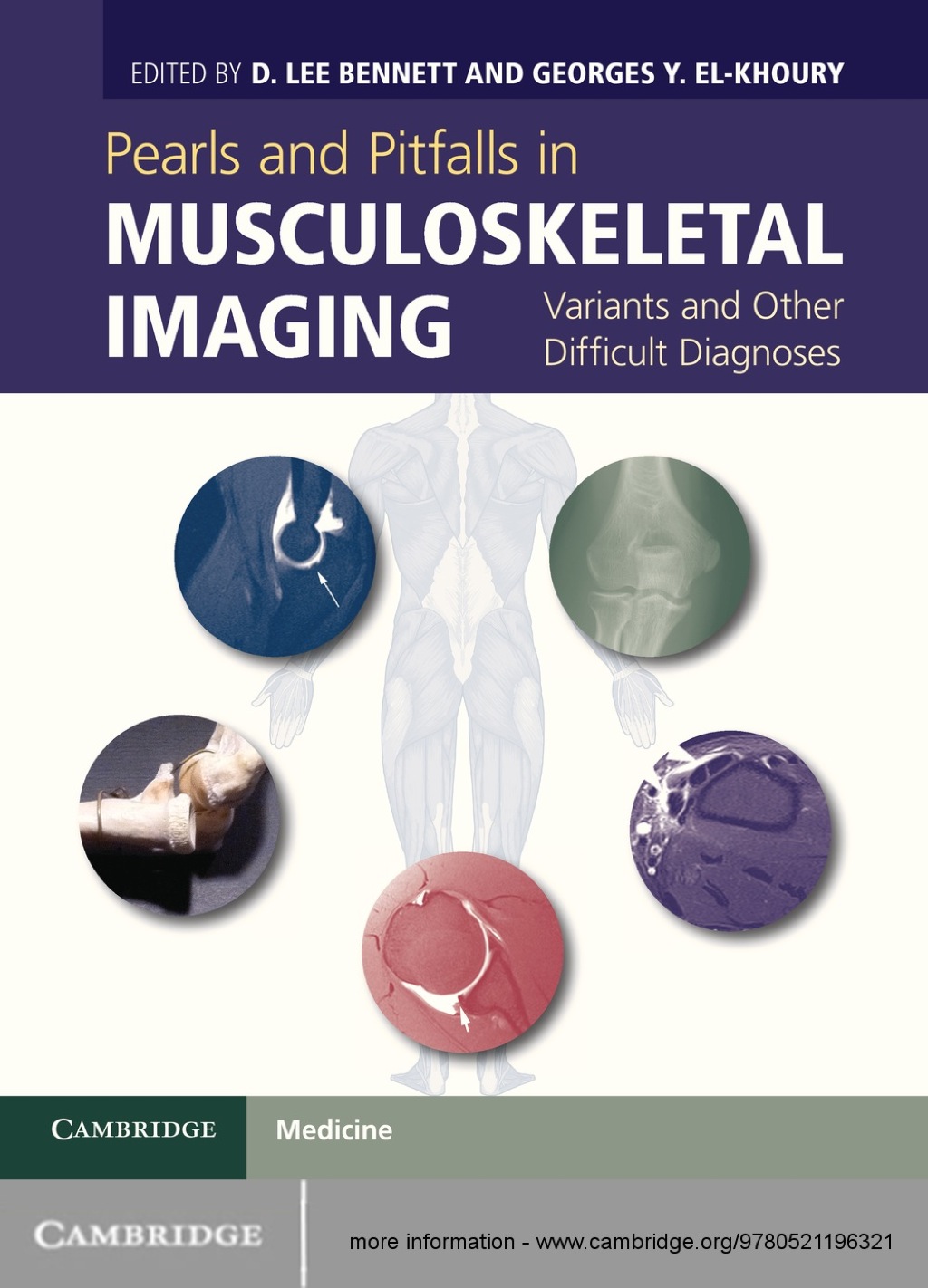 Pearls and Pitfalls in Musculoskeletal Imaging Variants and Other Difficult Diagnoses 1st Edition â€“ PDF/EPUB Version Downloadable