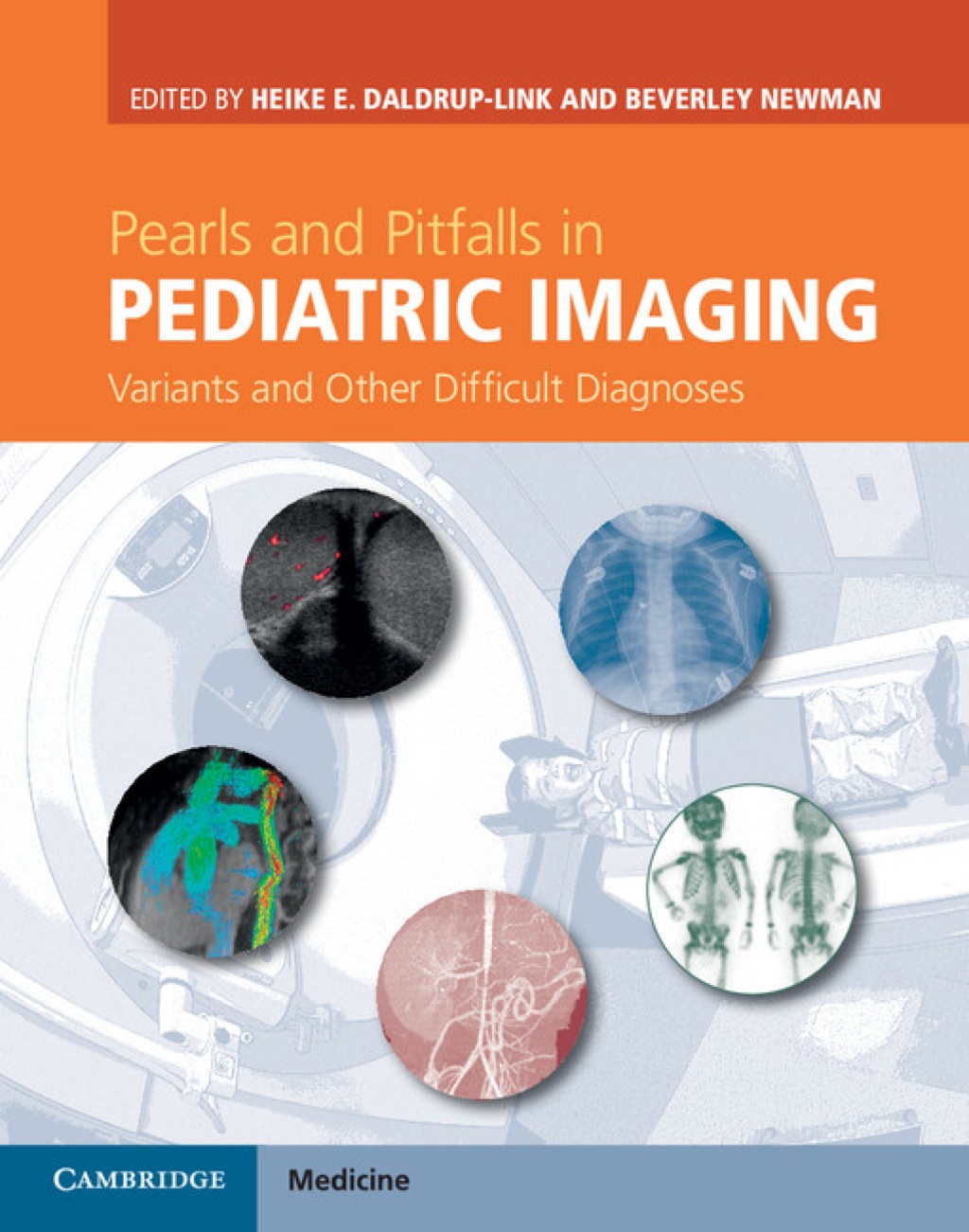 Pearls and Pitfalls in Pediatric Imaging Variants and Other Difficult Diagnoses 1st Edition â€“ PDF/EPUB Version Downloadable