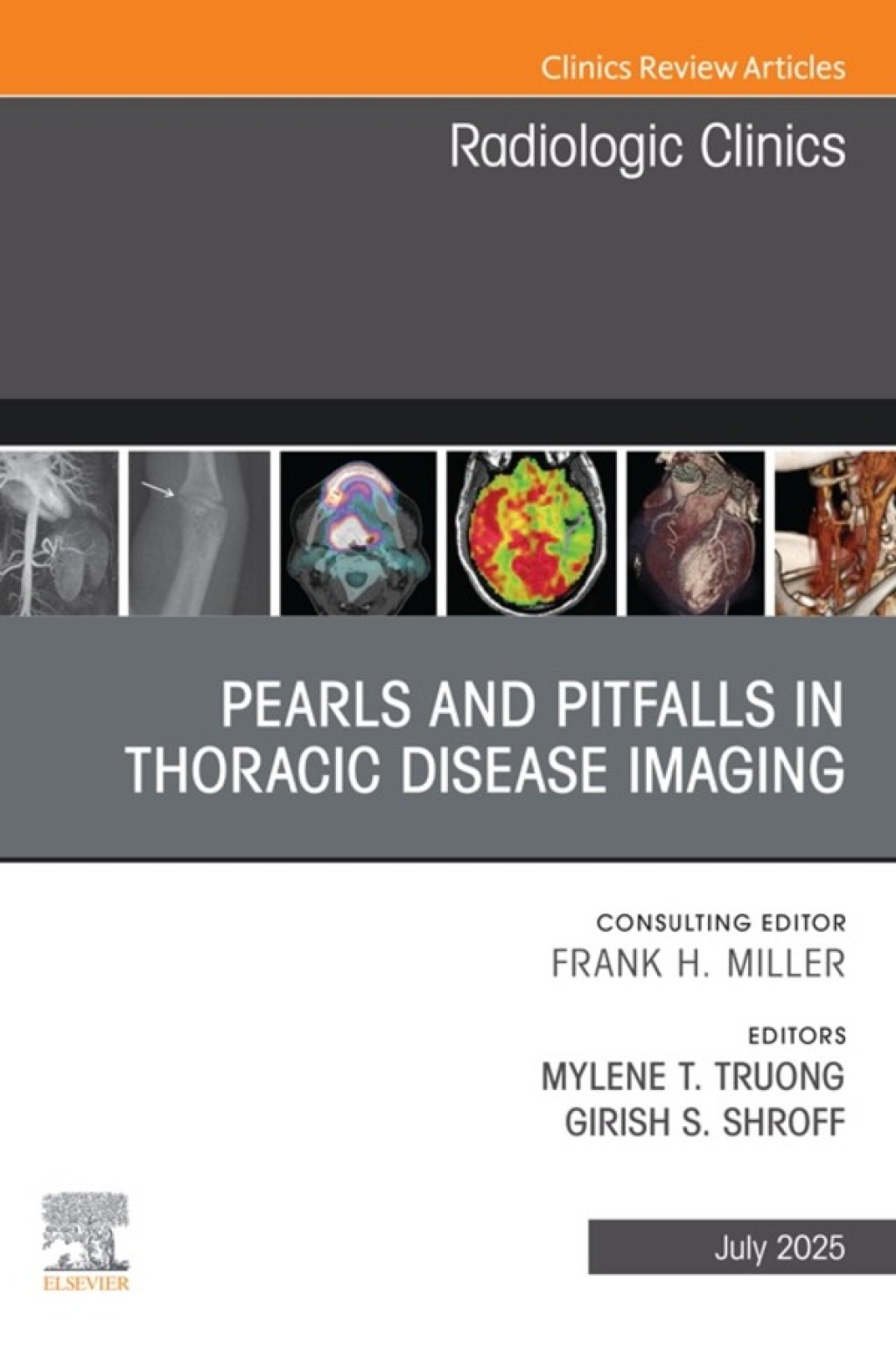 Pearls and Pitfalls in Thoracic Disease Imaging, An Issue of Radiologic Clinics of North America  â€“ PDF/EPUB Version Downloadable
