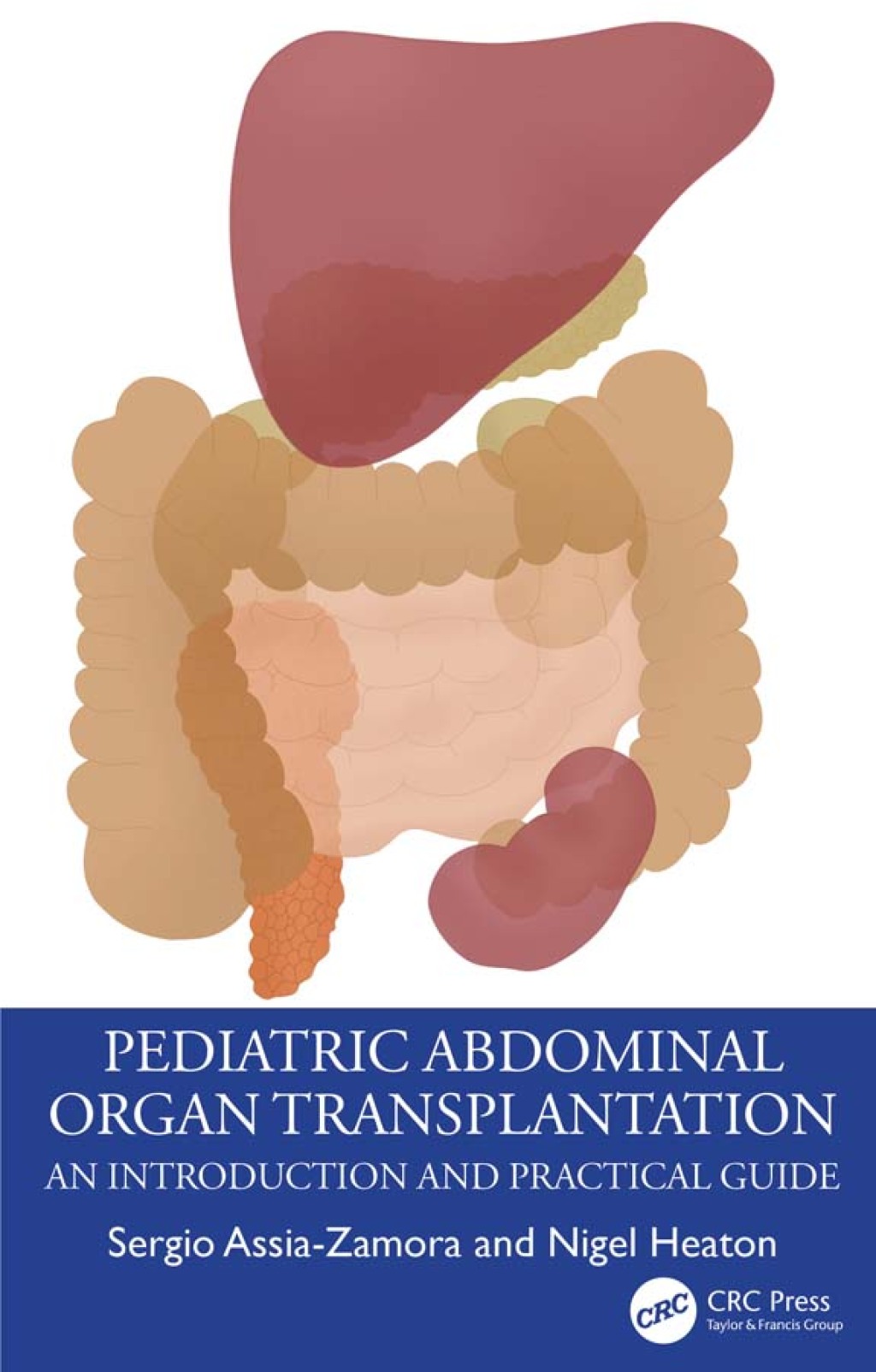 Pediatric Abdominal Organ Transplantation An Introduction and Practical guide 1st Edition â€“ PDF/EPUB Version Downloadable