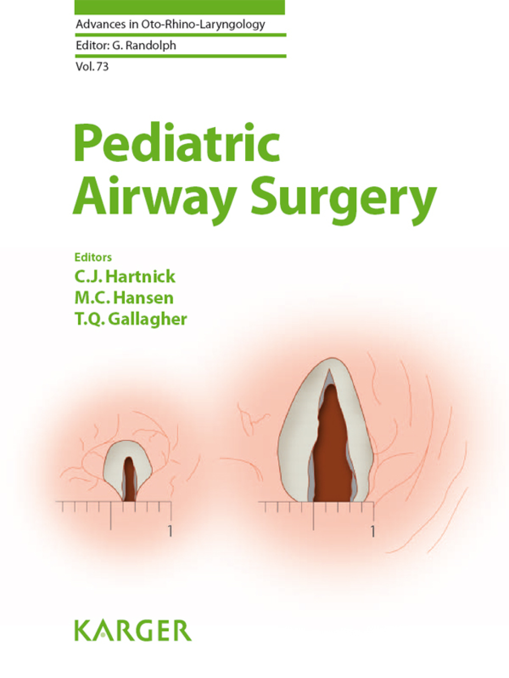 Pediatric Airway Surgery 1st Edition â€“ PDF/EPUB Version Downloadable