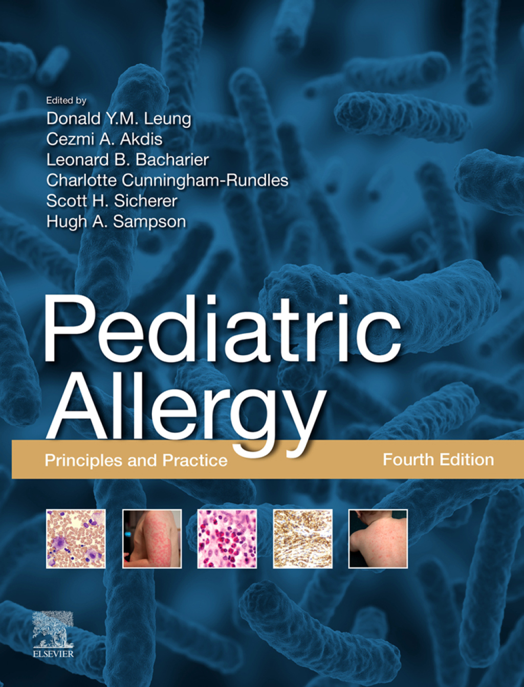 Pediatric Allergy Principles and Practice 4th Edition â€“ PDF/EPUB Version Downloadable