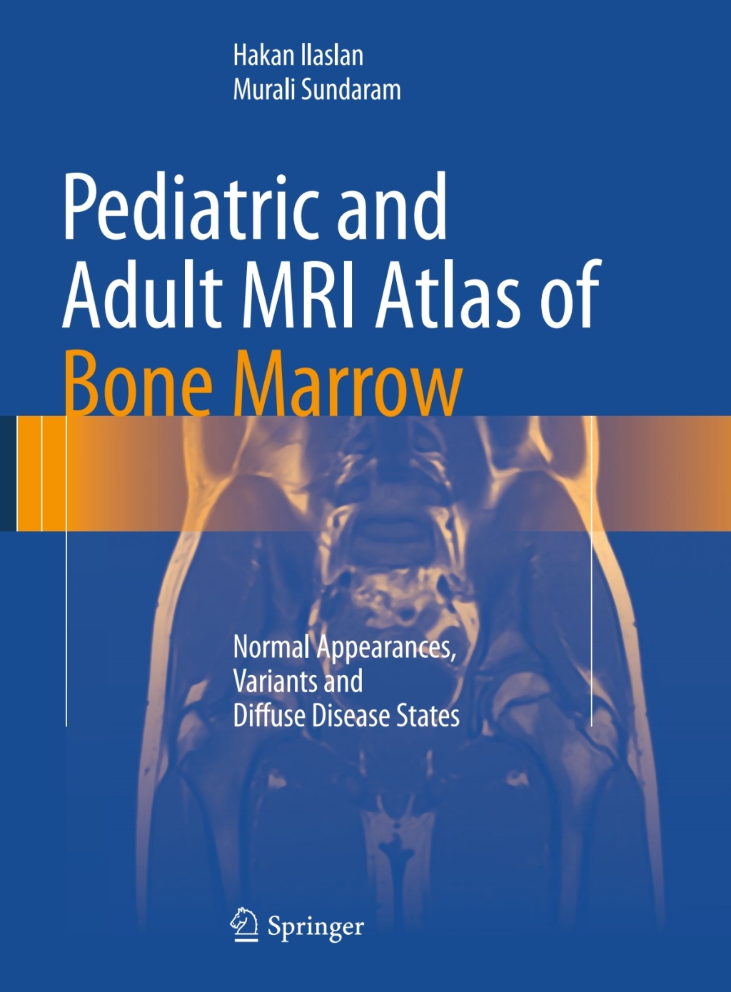Pediatric and Adult MRI Atlas of Bone Marrow Normal Appearances, Variants and Diffuse Disease States  â€“ PDF/EPUB Version Downloadable