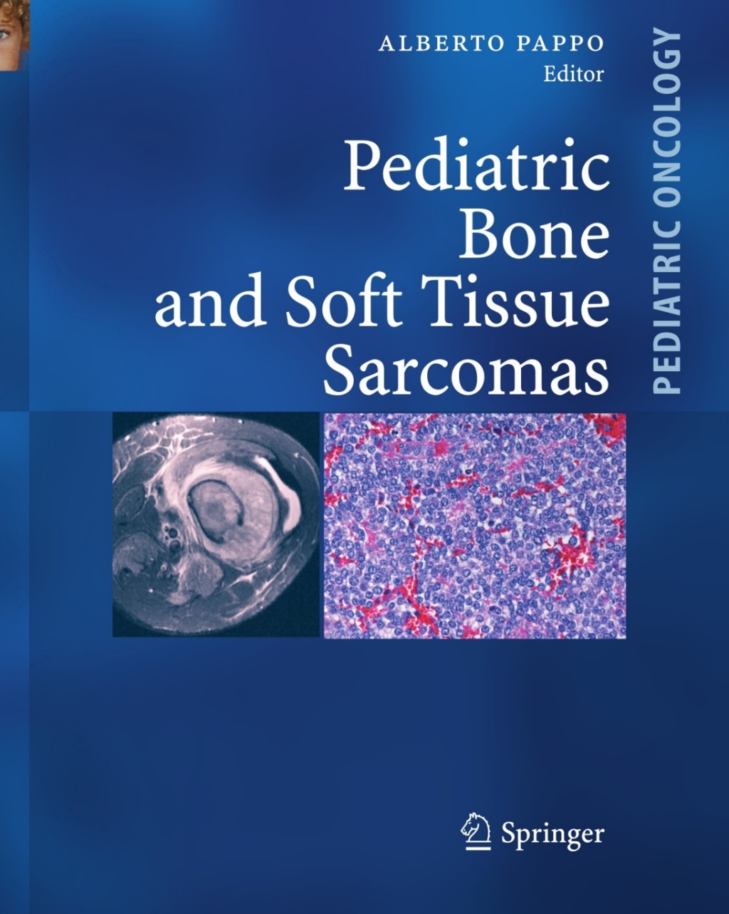 Pediatric Bone and Soft Tissue Sarcomas  â€“ PDF/EPUB Version Downloadable