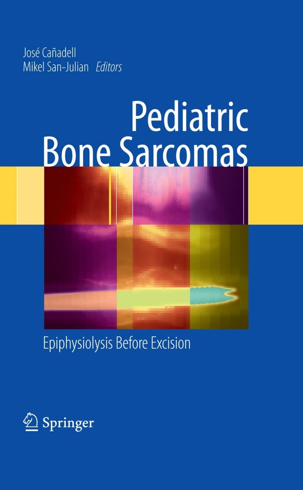 Pediatric Bone Sarcomas Epiphysiolysis before excision 1st Edition â€“ PDF/EPUB Version Downloadable
