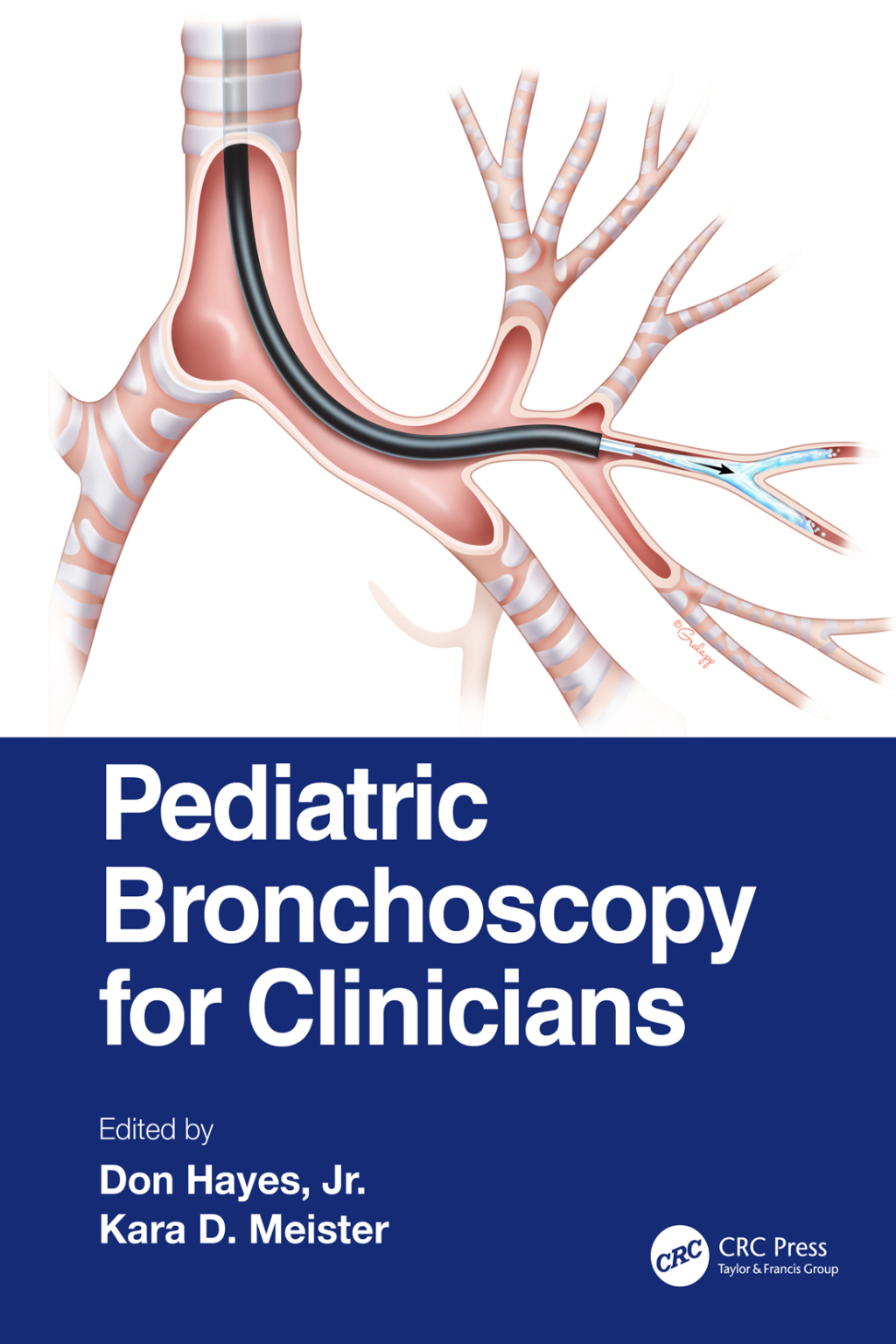 Pediatric Bronchoscopy for Clinicians 1st Edition â€“ PDF/EPUB Version Downloadable