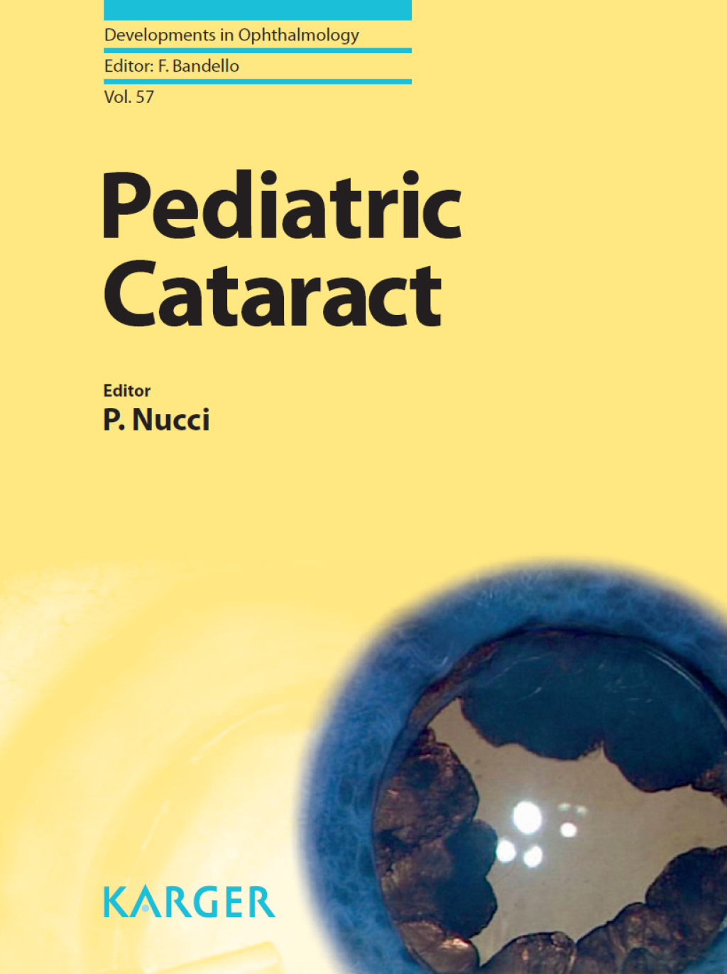 Pediatric Cataract 1st Edition â€“ PDF/EPUB Version Downloadable