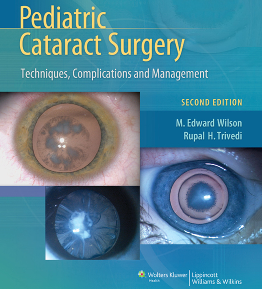 Pediatric Cataract Surgery Techniques, Complications and Management 2nd Edition â€“ PDF/EPUB Version Downloadable