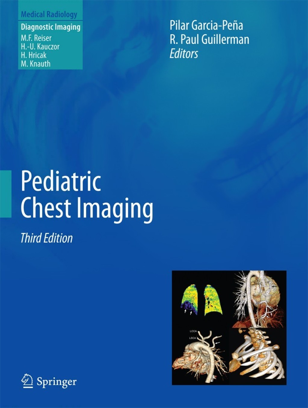 Pediatric Chest Imaging 3rd Edition â€“ PDF/EPUB Version Downloadable