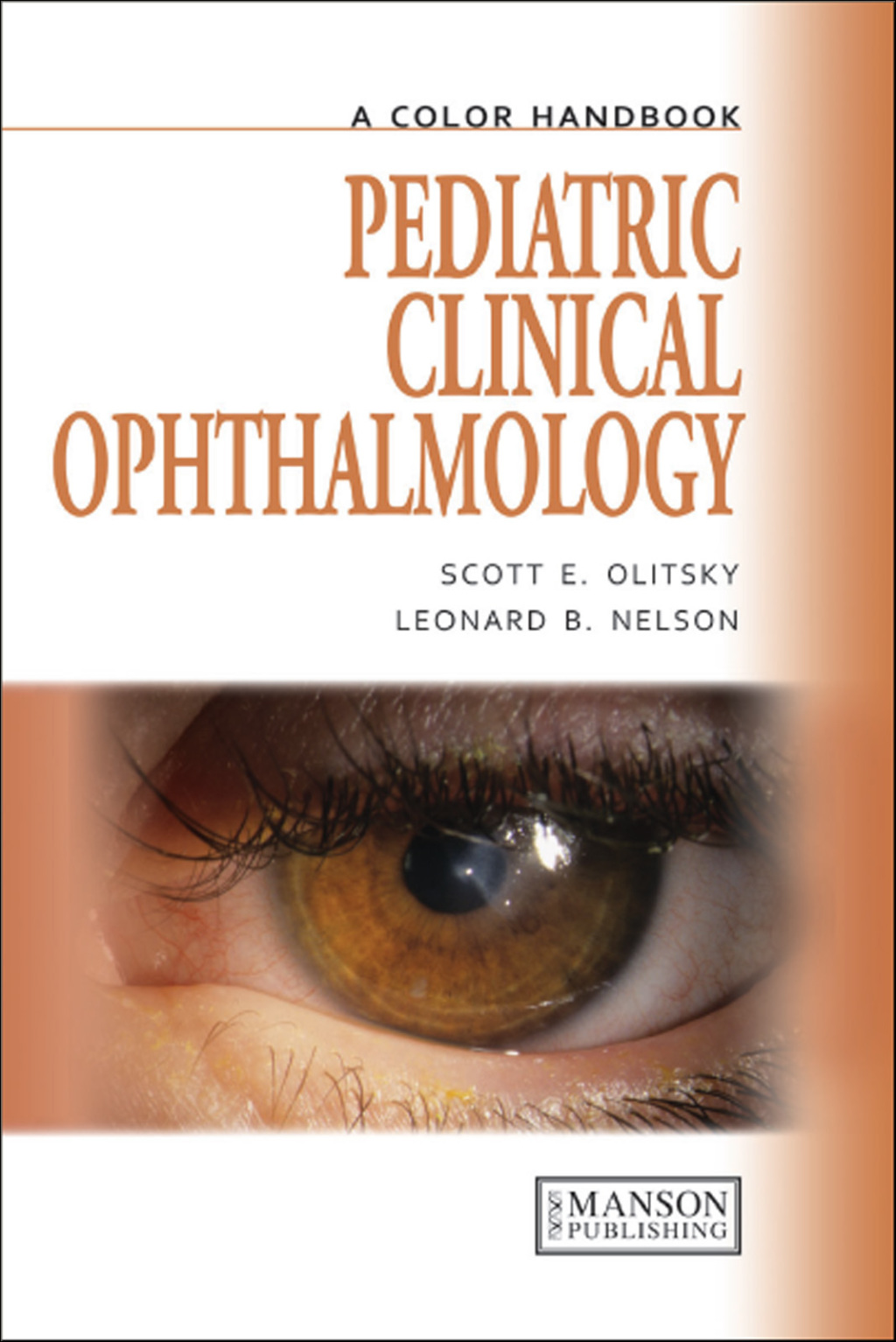 Pediatric Clinical Ophthalmology A Color Handbook 1st Edition â€“ PDF/EPUB Version Downloadable