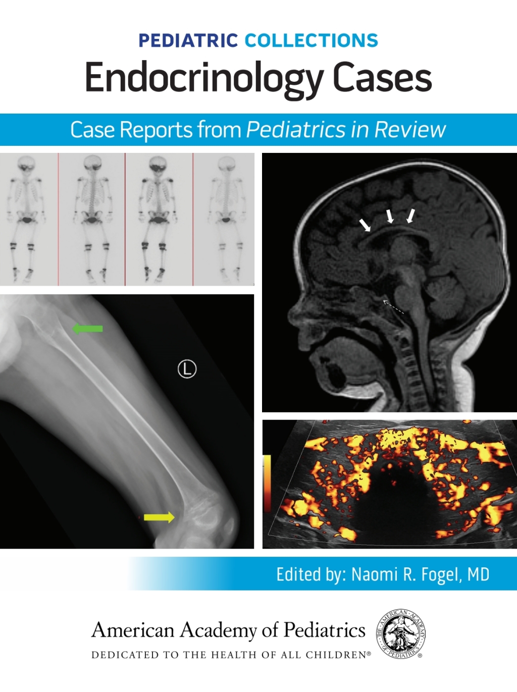 Pediatric Collections: Endocrinology Cases: Case Reports from Pediatrics in Review  â€“ PDF/EPUB Version Downloadable