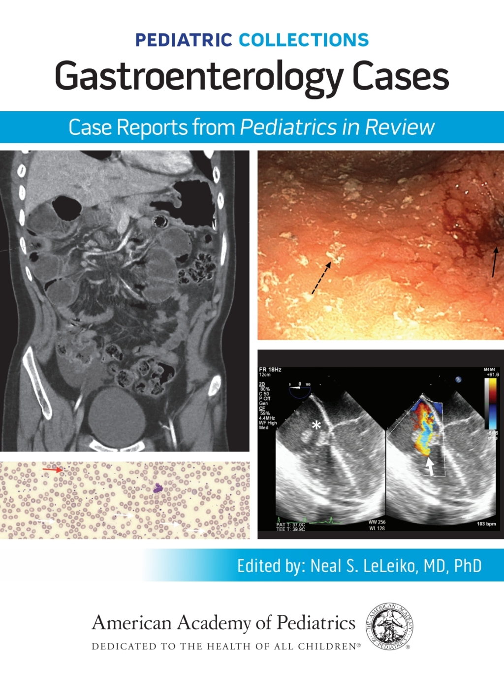 Pediatric Collections: Gastroenterology Cases: Case Reports from Pediatrics in Review  â€“ PDF/EPUB Version Downloadable