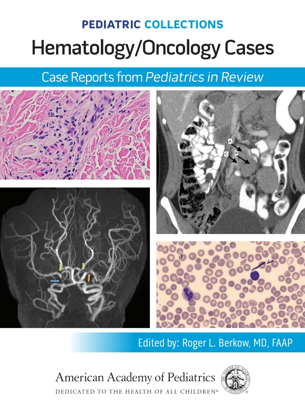 Pediatric Collections: Hematology/Oncology Cases: Case Reports from Pediatrics in Review  â€“ PDF/EPUB Version Downloadable