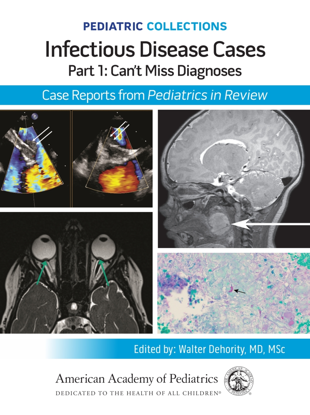 Pediatric Collections: Infectious Disease Cases: Part 1: Canâ€™t Miss Diagnoses: Case Reports from Pediatrics in Review  â€“ PDF/EPUB Version Downloadable