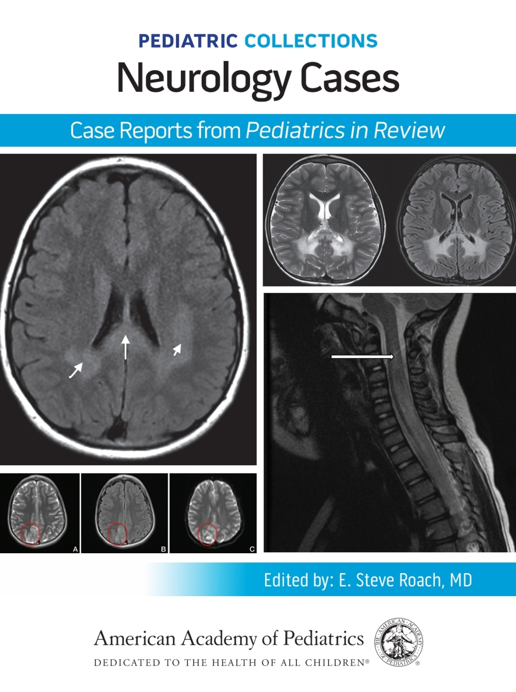 Pediatric Collections: Neurology Cases: Case Reports from Pediatrics in Review  â€“ PDF/EPUB Version Downloadable