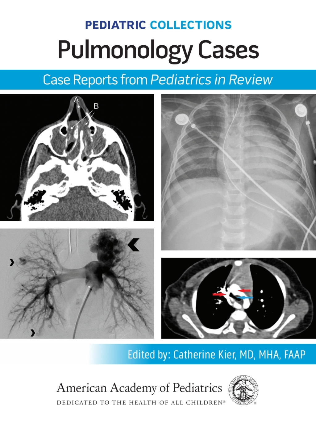 Pediatric Collections: Pulmonology Cases: Case Reports from Pediatrics in Review  â€“ PDF/EPUB Version Downloadable