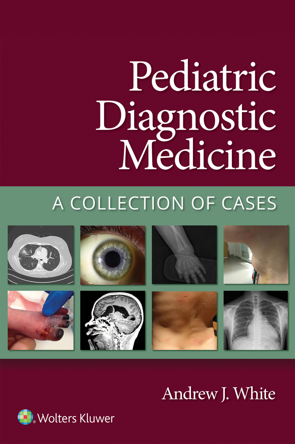 Pediatric Diagnostic Medicine A Collection of Cases  â€“ PDF/EPUB Version Downloadable