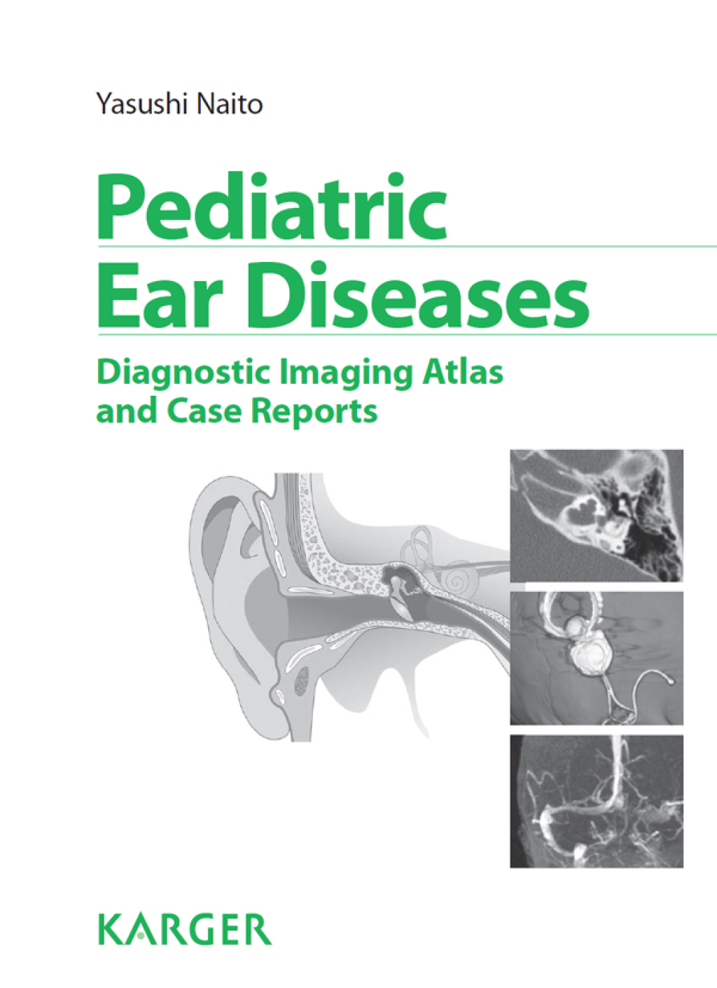 Pediatric Ear Diseases Diagnostic Imaging Atlas and Case Reports 1st Edition â€“ PDF/EPUB Version Downloadable