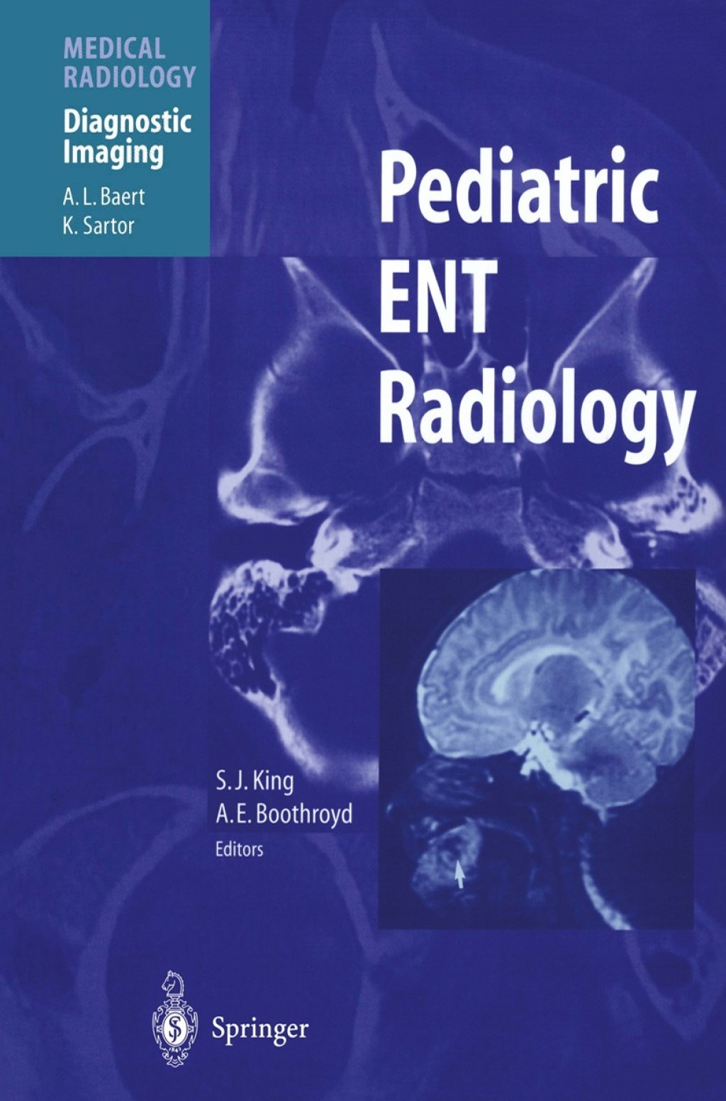 Pediatric ENT Radiology 1st Edition â€“ PDF/EPUB Version Downloadable