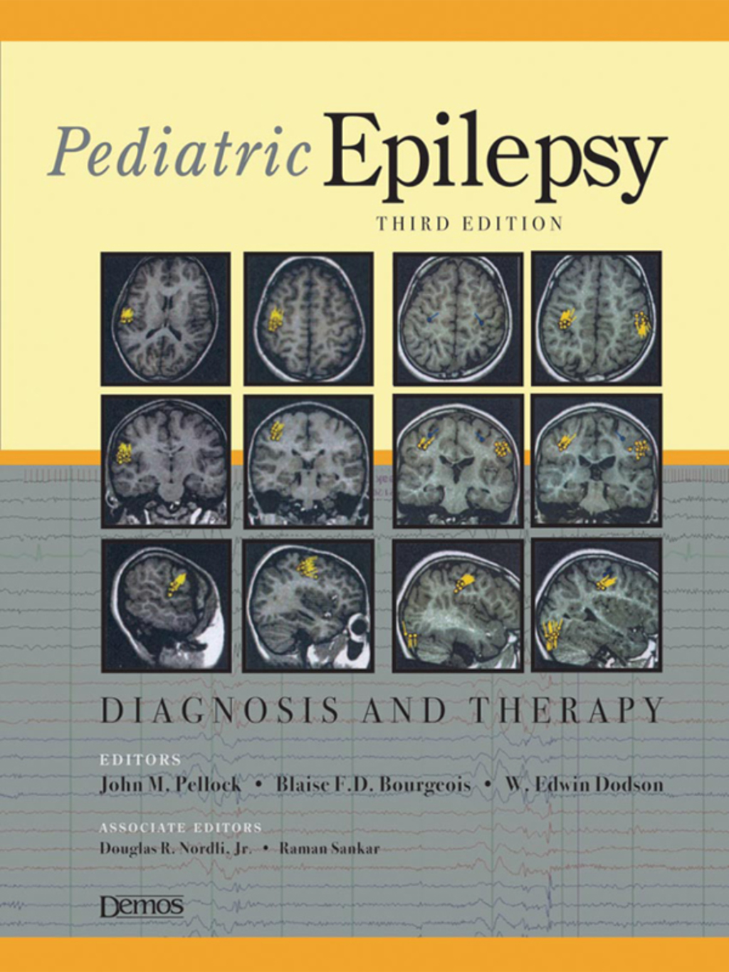 Pediatric Epilepsy Diagnosis and Therapy 3rd Edition â€“ PDF/EPUB ...
