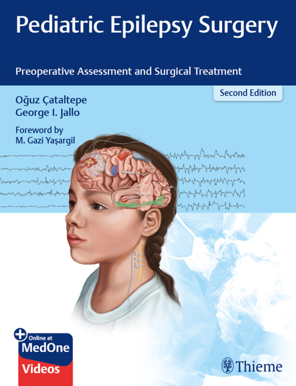 Pediatric Epilepsy Surgery Preoperative Assessment and Surgical Treatment 2nd Edition â€“ PDF/EPUB Version Downloadable