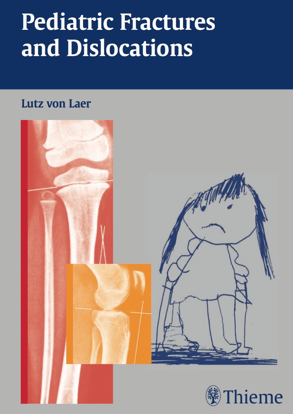 Pediatric Fractures and Dislocations 1st Edition â€“ PDF/EPUB Version Downloadable