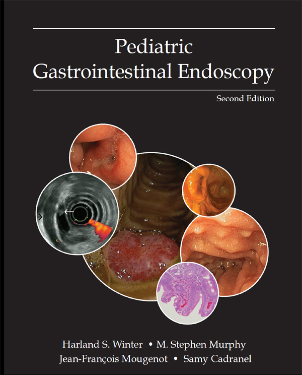 Pediatric Gastrointestinal Endoscopy 2nd Edition – PDF/EPUB Version Downloadable
