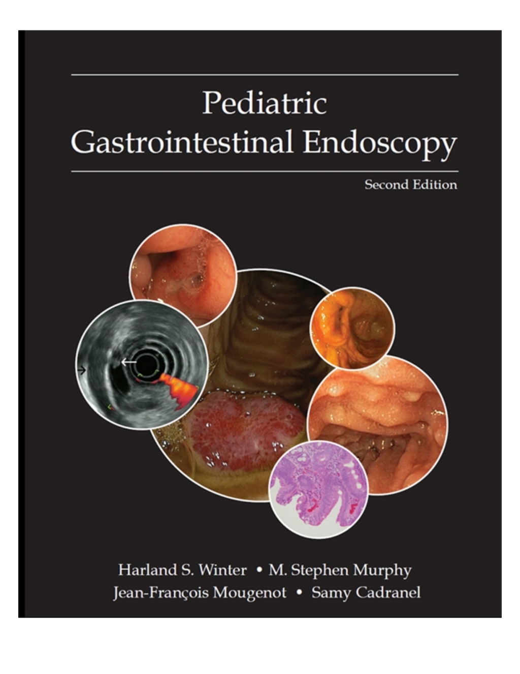 Pediatric Gastrointestinal Endoscopy 2nd Edition â€“ PDF/EPUB Version Downloadable
