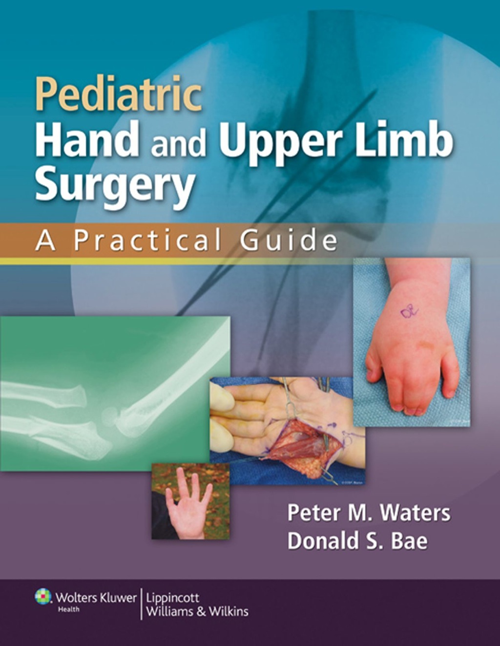 Pediatric Hand and Upper Limb Surgery A Practical Guide 1st Edition â€“ PDF/EPUB Version Downloadable