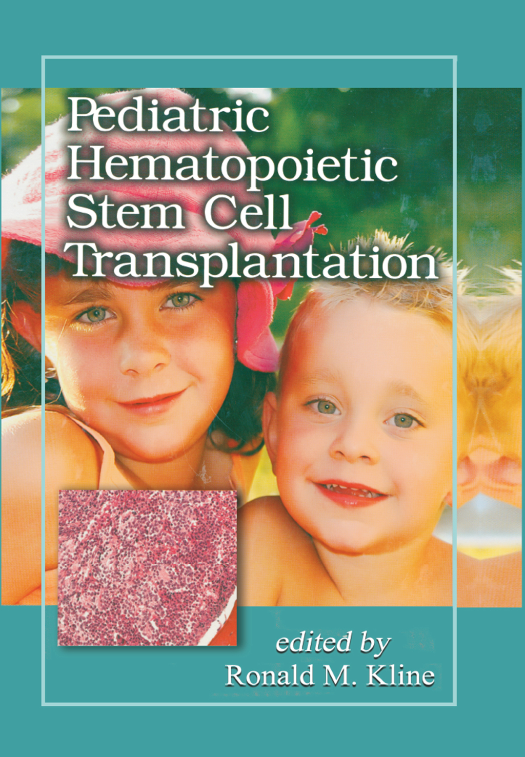 Pediatric Hematopoietic Stem Cell Transplantation 1st Edition â€“ PDF/EPUB Version Downloadable