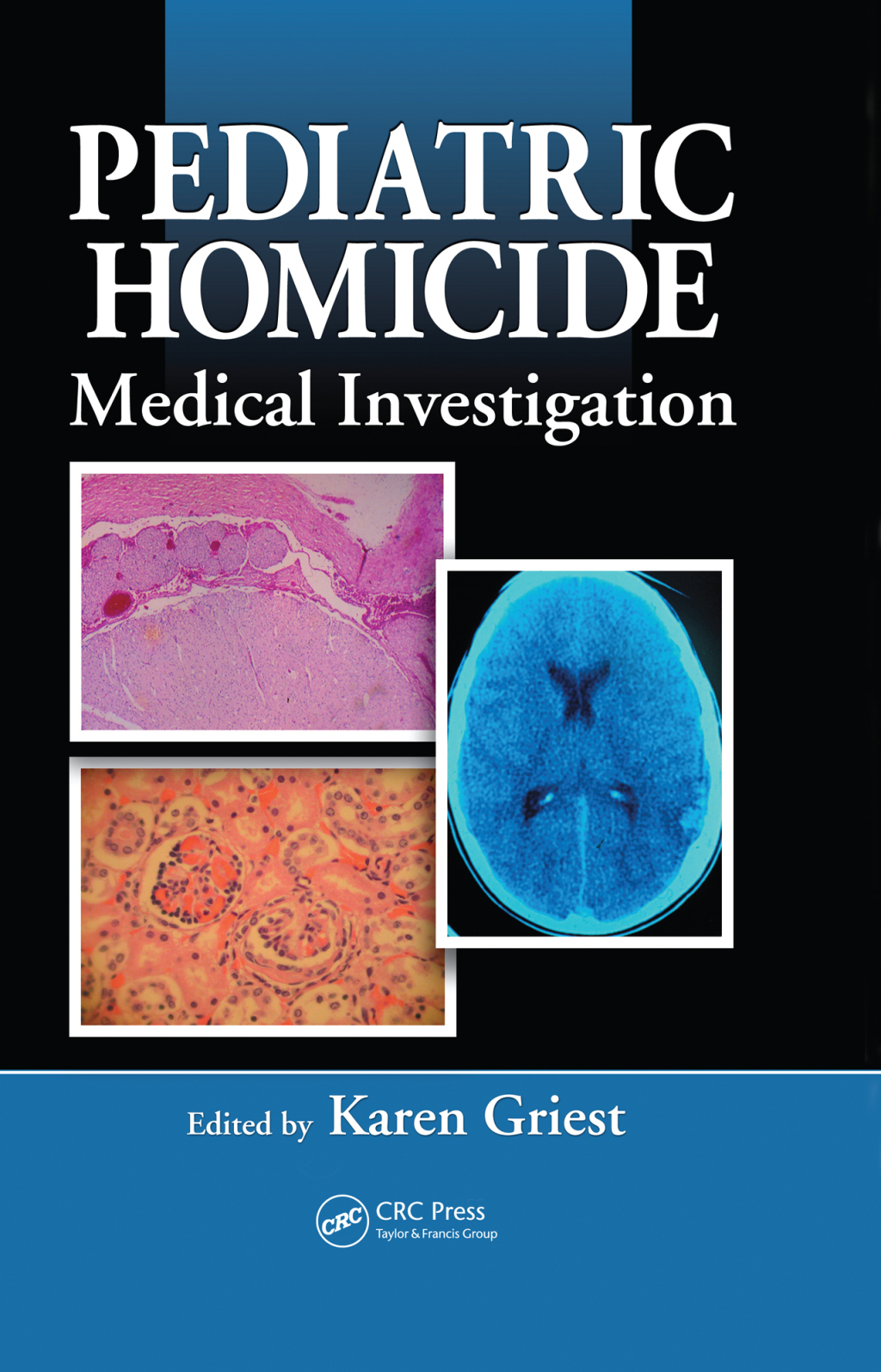 Pediatric Homicide Medical Investigation 1st Edition â€“ PDF/EPUB Version Downloadable