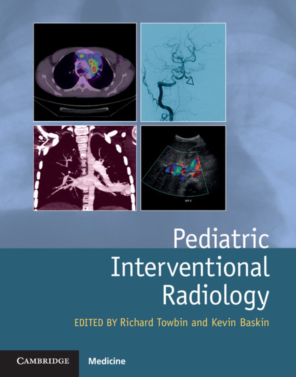 Pediatric Interventional Radiology 1st Edition â€“ PDF/EPUB Version Downloadable