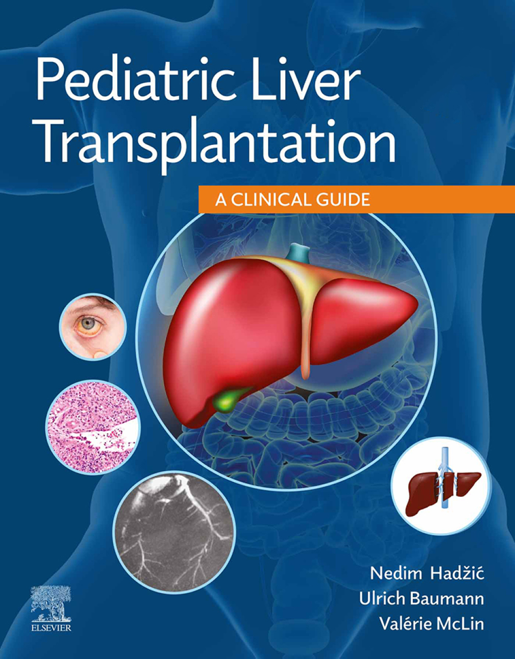 Pediatric Liver Transplantation A Clinical Guide  â€“ PDF/EPUB Version Downloadable