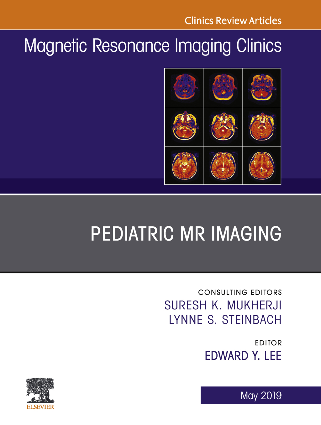 Pediatric MR Imaging, An Issue of Magnetic Resonance Imaging Clinics of North America  â€“ PDF/EPUB Version Downloadable