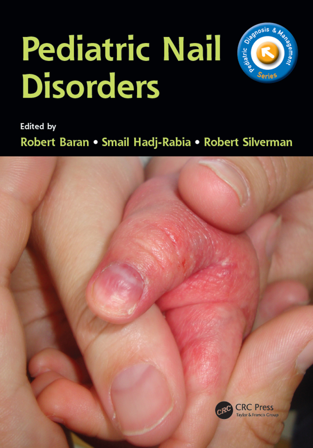 Pediatric Nail Disorders 1st Edition â€“ PDF/EPUB Version Downloadable