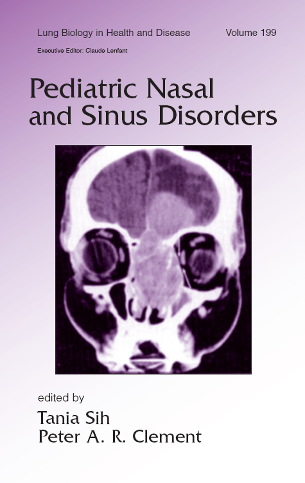 Pediatric Nasal and Sinus Disorders 1st Edition â€“ PDF/EPUB Version Downloadable