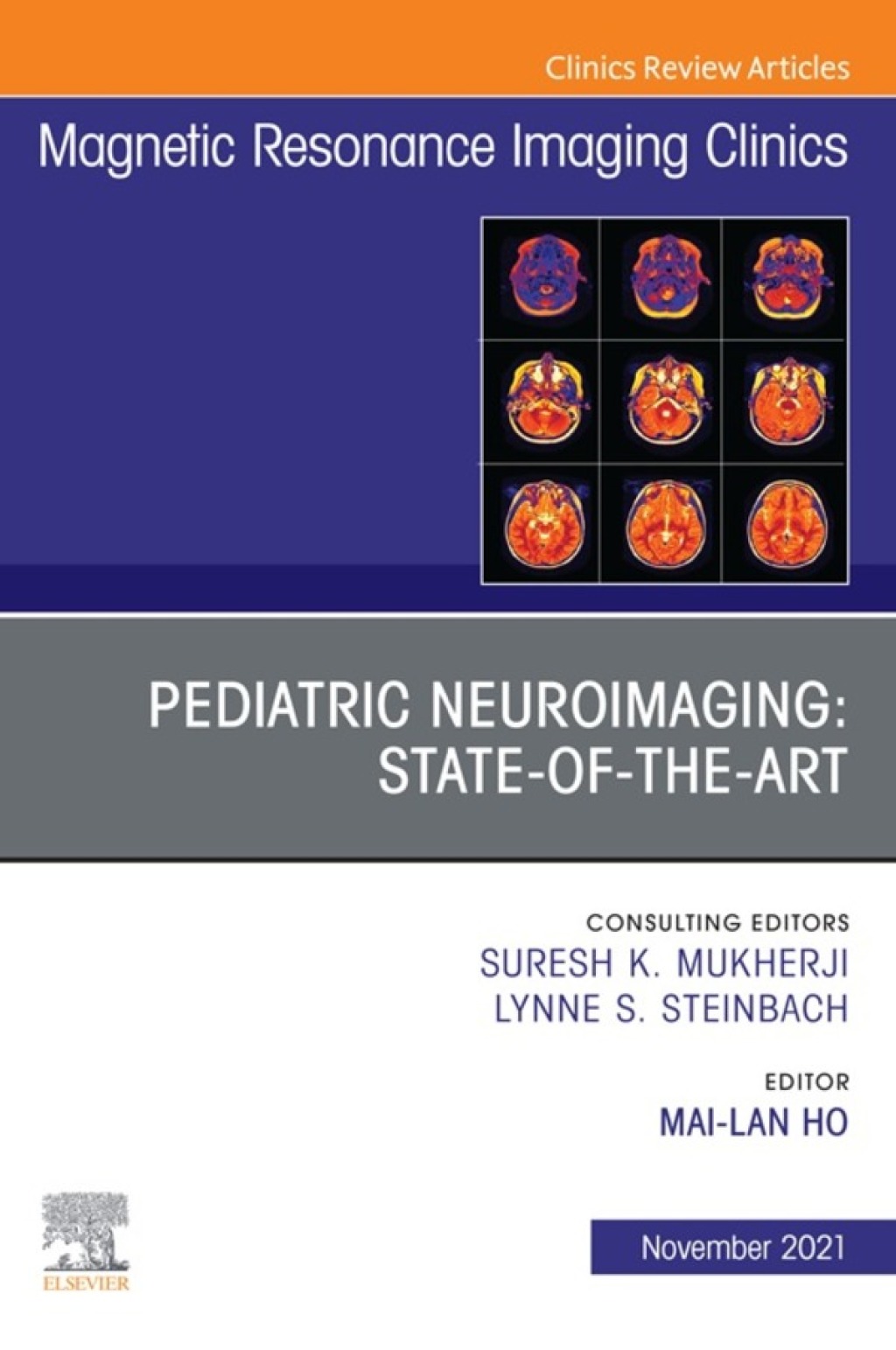 Pediatric Neuroimaging: State-of-the-Art, An Issue of Magnetic Resonance Imaging Clinics of North America  â€“ PDF/EPUB Version Downloadable