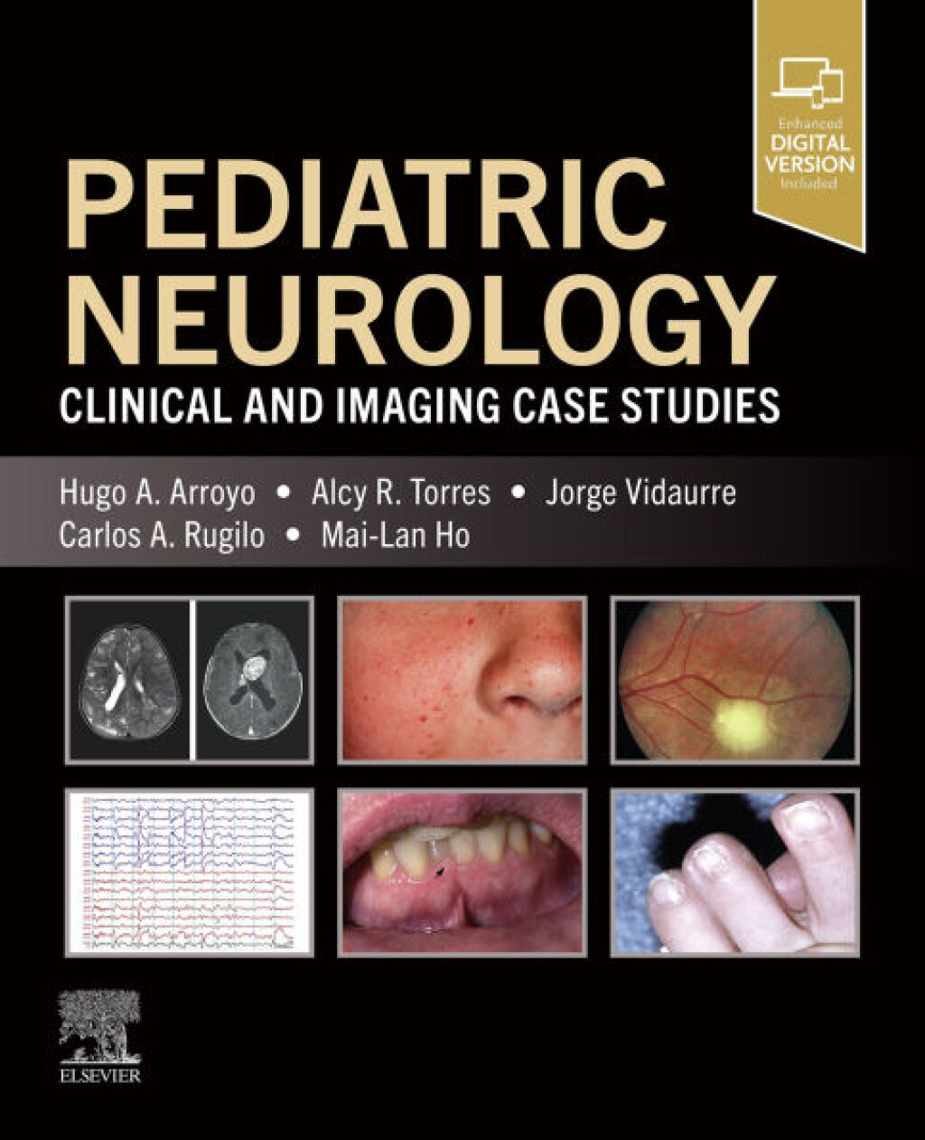 Pediatric Neurology Clinical and Imaging Case Studies  â€“ PDF/EPUB Version Downloadable