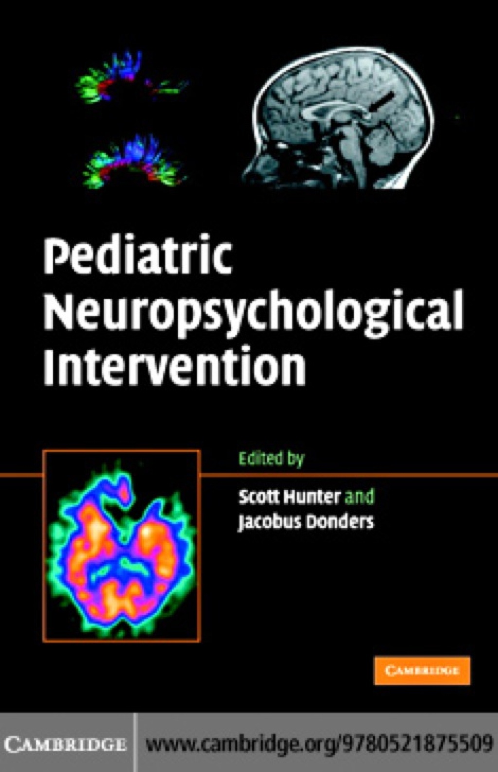 Pediatric Neuropsychological Intervention 1st Edition â€“ PDF/EPUB Version Downloadable