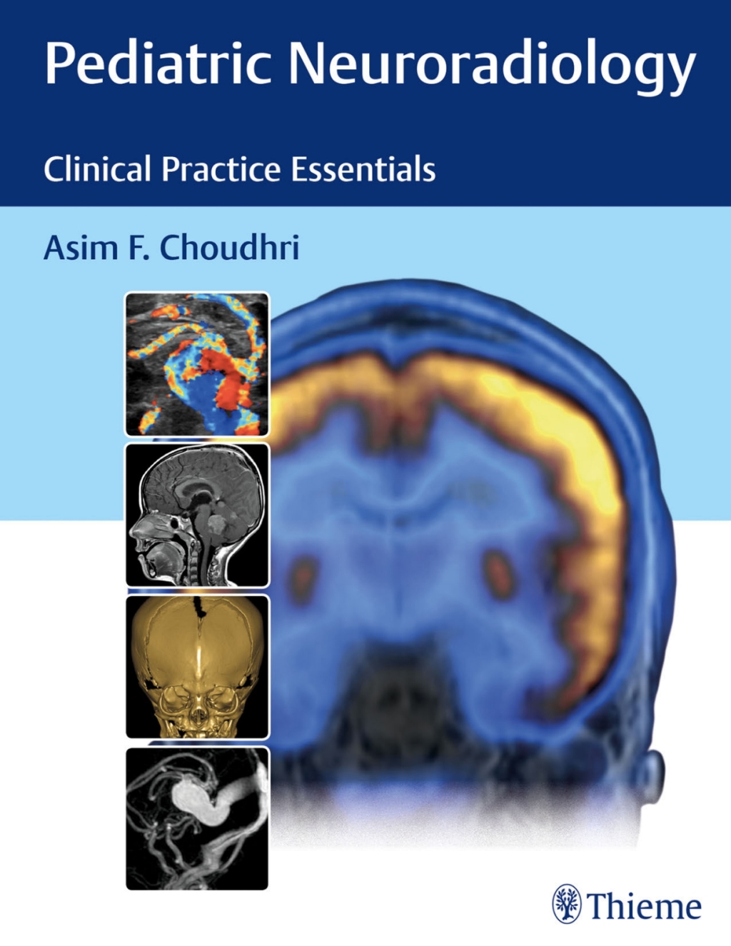 Pediatric Neuroradiology Clinical Practice Essentials 1st Edition â€“ PDF/EPUB Version Downloadable