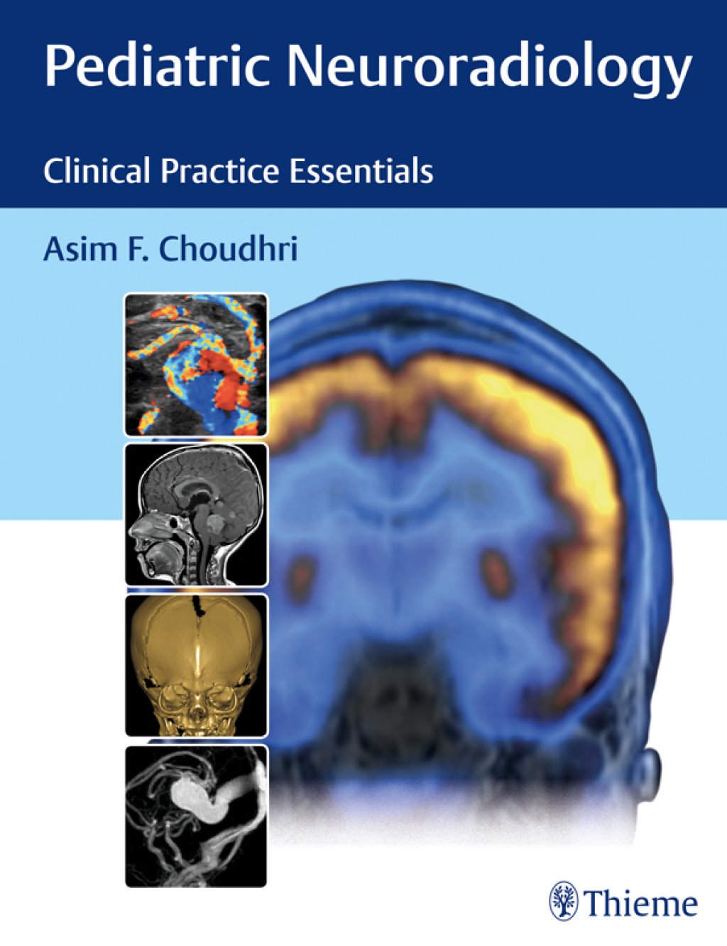 Pediatric Neuroradiology Clinical Practice Essentials 1st Edition – PDF/EPUB Version Downloadable Pediatric Neuroradiology Clinical Practice Essentials 1st Edition – PDF/EPUB Version Downloadable - Image 1