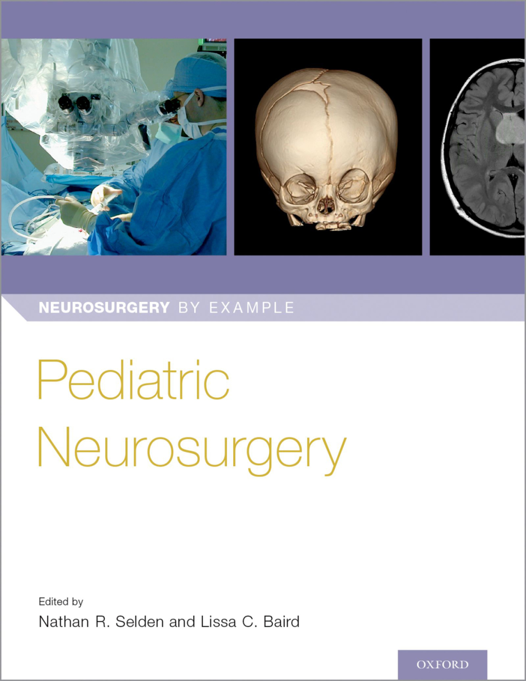 Pediatric Neurosurgery 1st Edition â€“ PDF/EPUB Version Downloadable