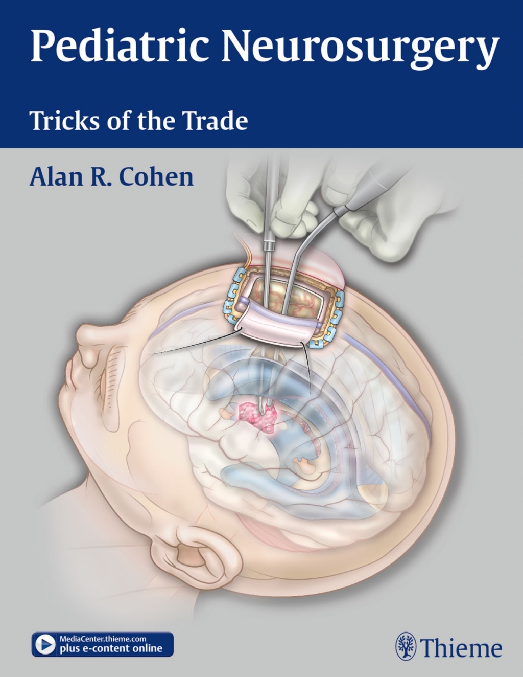 Pediatric Neurosurgery: Tricks of the Trade 1st Edition â€“ PDF/EPUB Version Downloadable