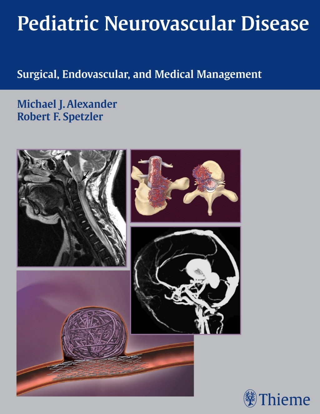 Pediatric Neurovascular Disease Surgical, Endovascular, and Medical Management 1st Edition â€“ PDF/EPUB Version Downloadable